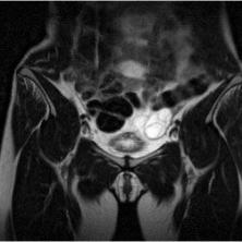 Kleines Becken & Unterbauch